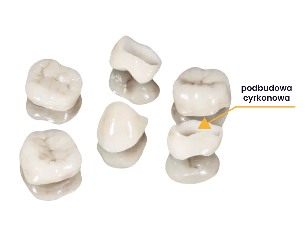 podbudowa cyrkonowa korony
